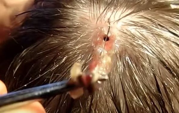 低胸正妹夹出巴拿马「马蝇」 美国男头顶留下