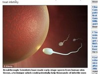 皮膚細胞竟能變精子！　科學家讓不孕男有望當爸爸