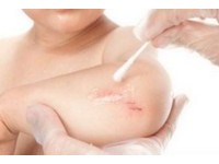 什麼規定?校護不能幫學生換藥 沒有處方連優碘都不能擦