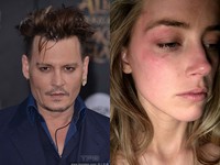 安珀赫德鬧離婚2度報警！　警車包圍強尼戴普住家