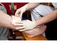 「雙氧水」其實沒有用? 研究:無法降低傷口上的細菌