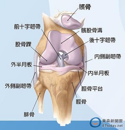 q角度变大,髌骨容易外翻,造成髌骨-股骨关节的外侧受力与磨损过大