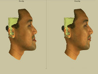 中國醫藥大學附設醫院擅用3D影像與患者「舒適溝通」