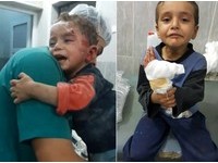 瓦礫堆中被拉出...敘利亞童臉沾鮮血　拚了命地抱緊護士