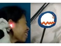 OO飛進耳朵! 她睡夢中痛醒⋯取出竟然還會「動」