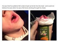 咬一口捲餅魚刺從臉頰刺出來　戰鬥男向麥當勞求償15萬