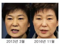 朴槿惠變身韓國整形活招牌　韓女瘋打美容針！