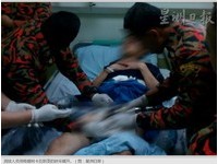 陰莖套鐵環自慰「GG腫成黑腸」 動員12消防員7hr才脫困