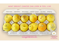 「12顆檸檬」看懂12種乳癌徵兆　腫瘤不再是唯一！