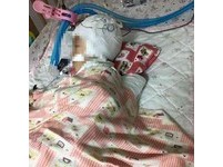 遭保母「頭下腳上」撞床　台南女童搶救1個月不治