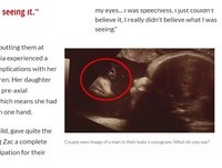 前兩胎基因缺陷...　孕婦第三胎超音波驚見「耶穌回眸」