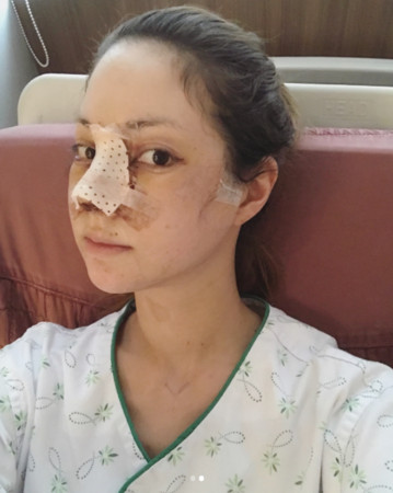 av女优蒂亚认了整容「削骨,垫鼻」术后素颜照曝光