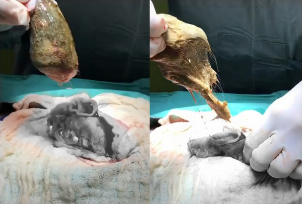 猫咪肚子塞毛球开刀.(图/翻摄自harbour city animal hospital脸书)
