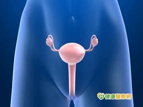 卵巢癌初期徵兆会胃肠不适 | ETtoday健康新闻
