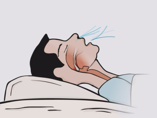 在放松入睡时, 能让下巴回到正常呼吸的位置