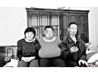 山西20歲女突患巨乳症　雙峰重10餘公斤垂到肚臍