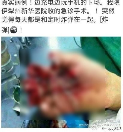 日前微博流传一名新疆伊犁男子因为边充电边玩手机,导致手机爆炸,5根