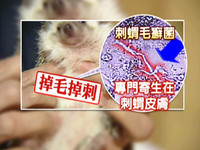 銅板大紅疹變成5倍大　養刺蝟「皮癬菌」上身《ETtoday 新聞雲》