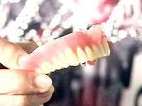 假牙成本1千賣5千　醫師：貴在技術《ETtoday 新聞雲》