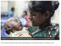 印度出生6天男嬰離奇「自燃」　母親遭控為錢刻意縱火