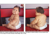 哥倫比亞「米其林女嬰」　10個月大體重飆破20公斤