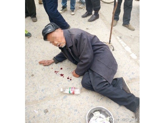 大陆中心/综合报导 安徽宿州市一名80岁老爷爷日前被发现在街上「吐血