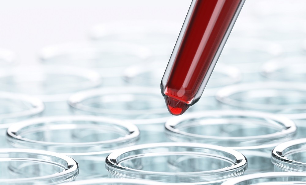 colombia)科学家发现人类肠道细菌中的酶可有效除去a和b型的抗原,若