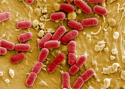 「超級細菌」具抗藥性　美國每15分鐘奪1命