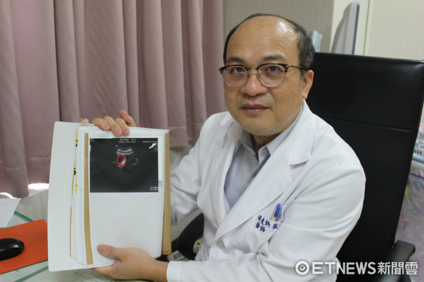 台中医院黄一文医师.(图/台中医院提供)