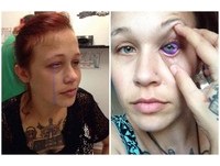 把眼白當畫布　24歲正妹刺青完流紫色眼淚...右眼將失明