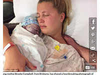 她懷孕36周臨盆前大失血　寶寶胎死腹中「還得忍痛分娩生下」