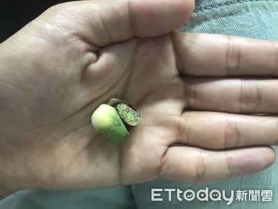 張嘴飄出臭水溝味「以為是小病」　他驗出口腔癌末期掛了