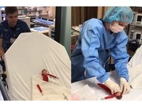 7歲妹的娃娃「被狗咬斷手」送急診　暖心醫生幫忙動手術
