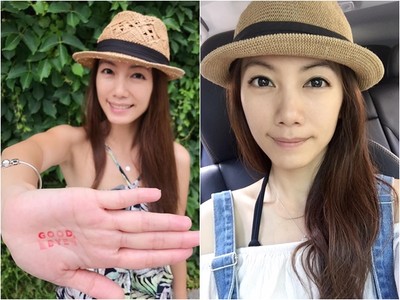 林韋君「半年嘴張不開」 怪病纏身..吃不了一顆貢丸
