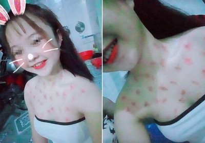 國中妹曬「吻痕戰績」！酥胸種大草莓　網酸電線桿：給男友狗尿