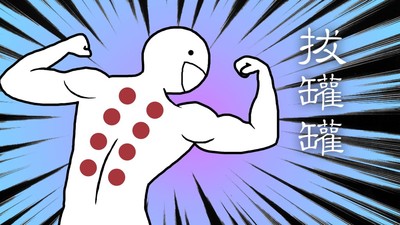 拔罐瘀血=火氣大？「6禁忌」不可拔！小心起水泡、皮潰爛