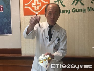 腳麻才知腰椎狹窄　這手術瞬間減壓「傷口比1元硬幣小」