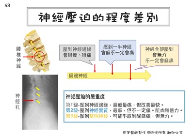 一張圖秒懂　神經壓迫的痠、痛、麻