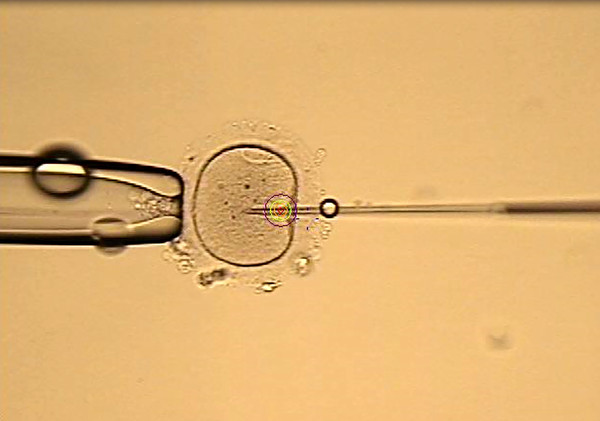 單一精蟲注射術照片。（圖／國泰醫院提供）