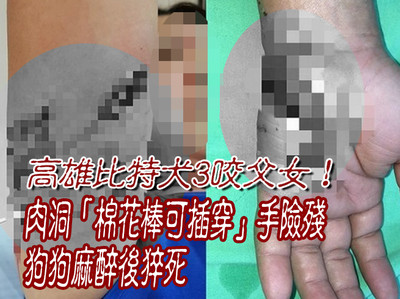 影／高雄比特犬3咬父女！肉洞「棉花棒可插穿」手險殘　狗狗麻醉後猝死