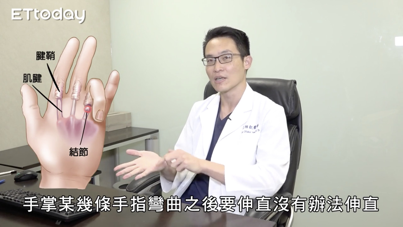 ▲3C成癮滑出「板機指」　醫師一招神解讓指頭不在僵硬。（圖／記者謝婷婷攝）