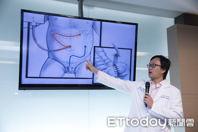 小兒罹罕病「無肛症」失禁滲便　馬龍式手術輔助灌腸