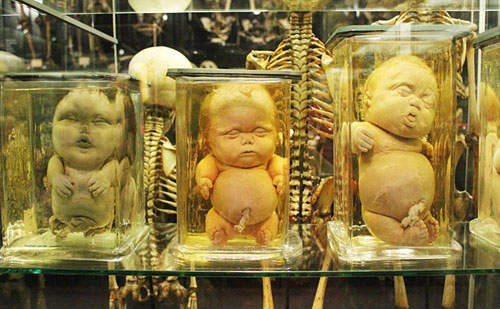 中国畸形婴儿博物馆图片