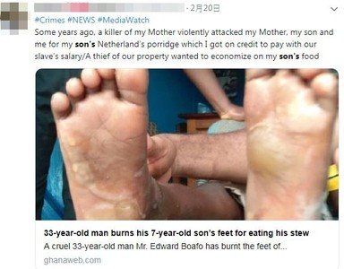 下班回家燉肉被吃光 鬼父逼7歲兒光腳站火堆上活烤