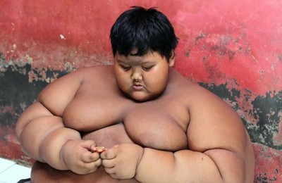 「最胖男孩」肥到無法翻身…躺原地吃5餐　狠甩100kg震驚眾人