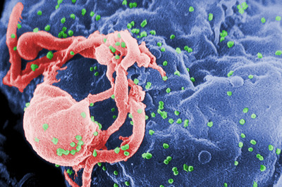 愛滋病有救了！停藥18個月HIV病毒消失　「倫敦病患」全球第二例
