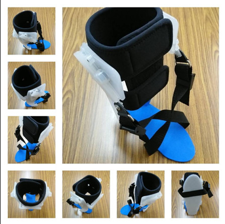 ▲▼ 北醫陳適卿醫師研發新式3D掃描列印足踝輔具          。（圖／台灣復健醫學會提供）