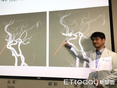 OL頭痛崩潰「像被棒球棍打到」 醫找出10年痛點:差點沒命