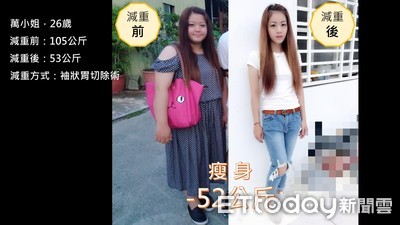 體重破百...胖到停經！少女縮胃手術甩52公斤3年沒復胖