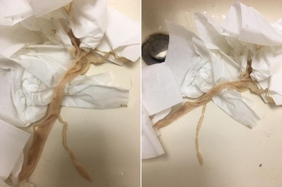 貓咪肛門卡線頭!台南妹好奇一拉「15cm異形肉片」捲竄狂爬 ... 嚇壞:母湯